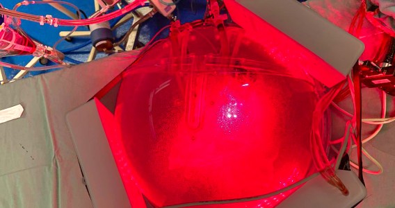 ‘Gêmeo digital’ do tórax simula aplicação de luz para tratamento de pneumonias