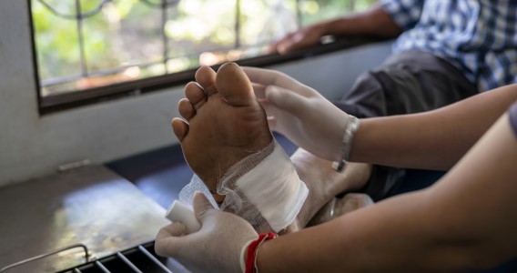 Nanopartícula combina duas estratégias para acelerar a cicatrização de feridas crônicas
