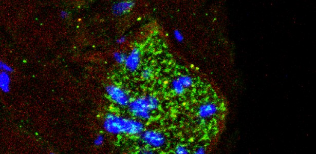 Imagem do nervo depressor aórtico mostrando molécula inflamatória interleucina-1β em verde e seu receptor em vermelho