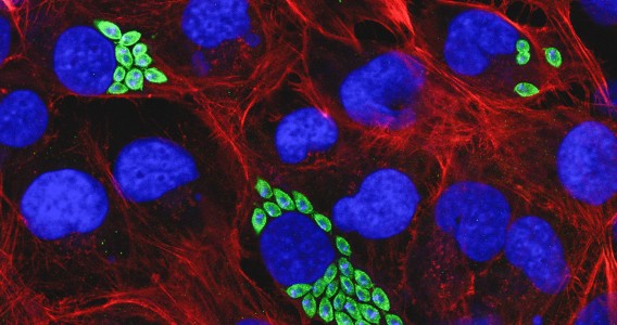 Proteína pouco conhecida é potencial alvo contra a doença de Chagas