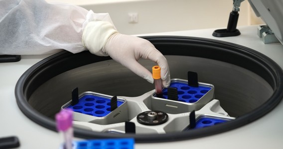 Marcadores no sangue podem prever eficácia de imunoterapia contra melanoma avançado